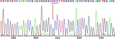 Functional Characterization of a Novel Heterozygous Mutation in the Glucokinase Gene That Causes MODY2 in Chinese Pedigrees